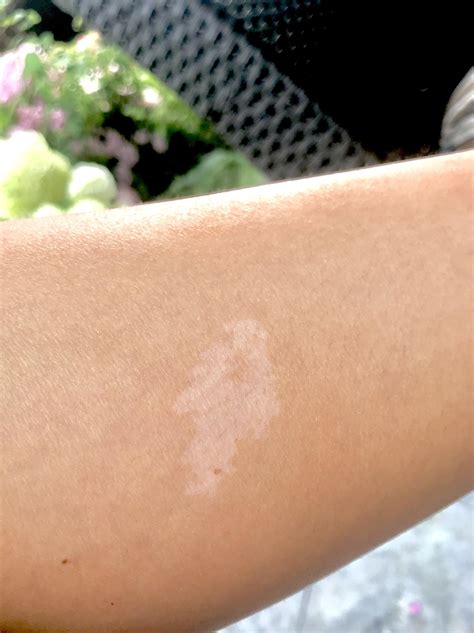 I Have An Upvote Shaped Birthmark On My Leg Rmildlyinteresting