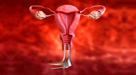 Malignant neoplastic disease en absoluto colo make out utero sintomas fotos. SAÚDE E SEXUALIDADE: Câncer no colo do útero, como fica a ...
