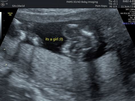 Gender Reveal Scan Private One On One Pregnancy And Fertility Ultrasound Scans Norwich Pams