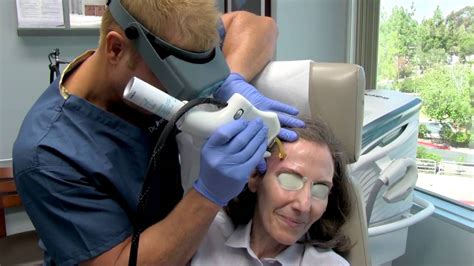 Facial Vein Treatment With Cooltouch Varia Laser Youtube