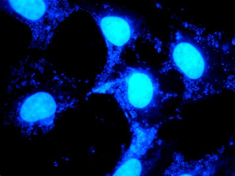 How To Solve Mycoplasma Contamination Issue In Lab