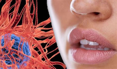 Cancer Symptoms This Common Mouth Problem Is A Sign Of Certain Types