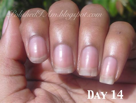 Peeling Nails Day 14600 Nail Care Hq