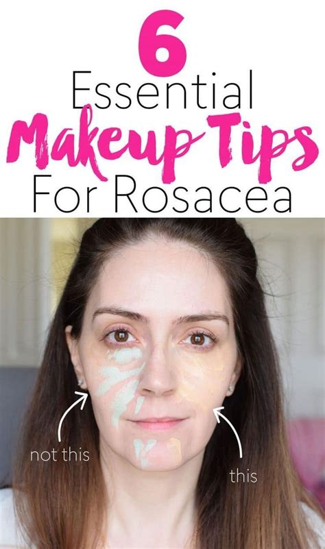 6 Essential Makeup Tips For Rosacea Face Makeup Tips Rosacea Makeup