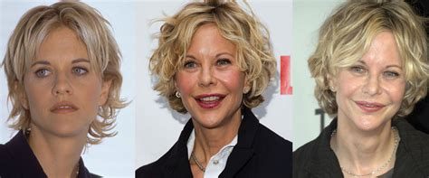 Everyone does, and meg ryan has a right to do so. Meg Ryan Plastic Surgery Before and After Pictures 2020