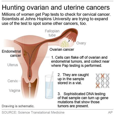 A Pap Test For Ovarian Cancer Scientists Retool Cervical Cancer Test