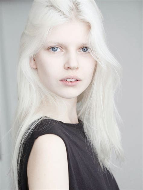 Pin En Albino Beauties