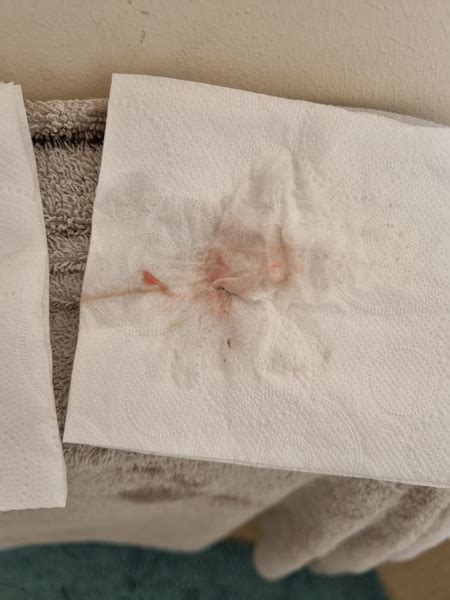 ⚠️ Warning Tmi Photos Does This Look Like Implantation Bleeding