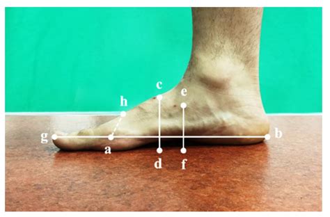 Ijerph Free Full Text Relationships Between Foot Morphology And