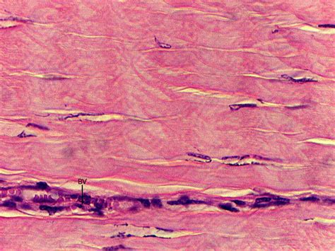 Dense Regular Connective Tissue Human Tendon Histology First