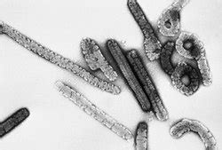 Sobre las características del virus del las autoridades sanitarias advierten que se debe detener en seco, la oms indica lo siguiente Marburgvirus - Wikipedia, la enciclopedia libre
