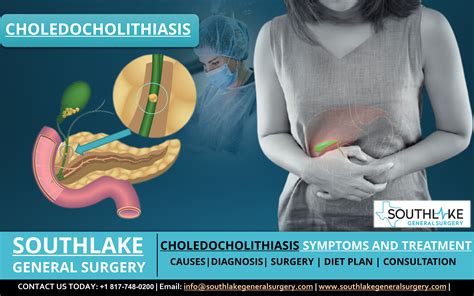 Choledocholithiasis Gallstones Bile Duct Gallstones Gallbladder Surgery