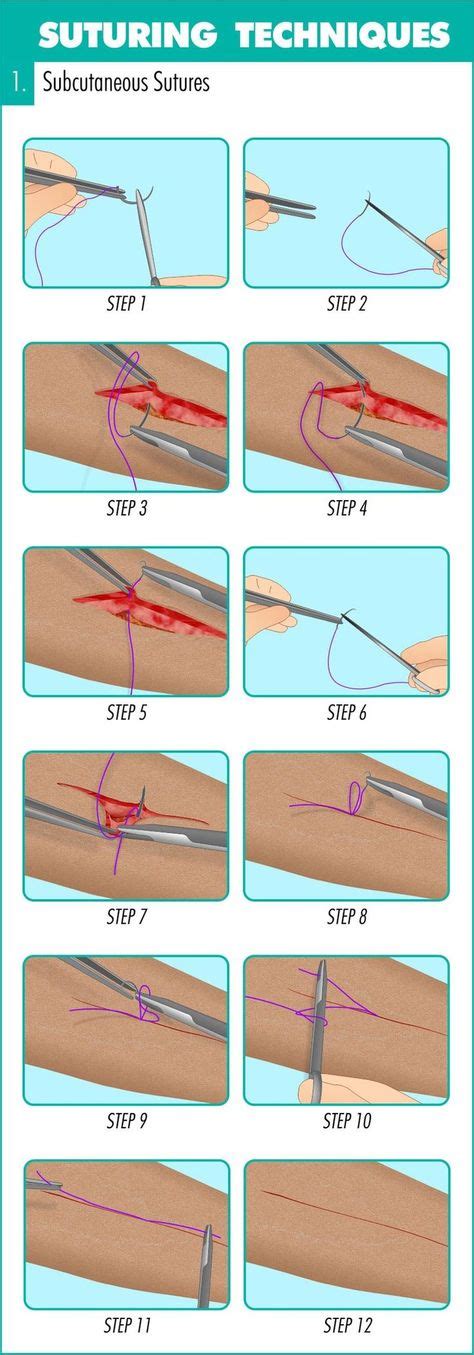 8 Best Surgical Suture Images Sutures Surgical Suture Medical Knowledge