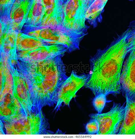 Real Fluorescence Microscopic View Human Skin Stock Photo 465564992