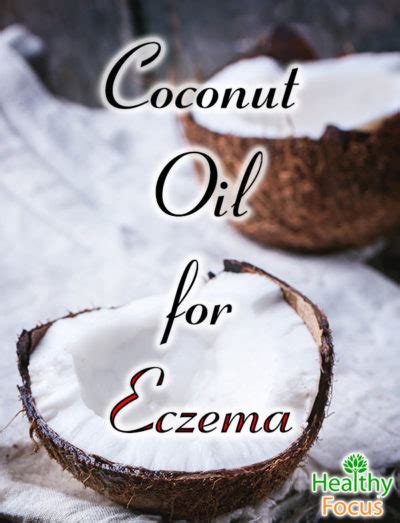 The Best Way To Use Coconut Oil For Eczema Healthy Focus