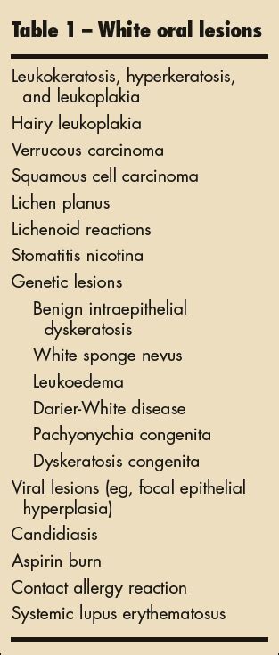 White Oral Lesions How To Distinguish The Benign From The Deadly