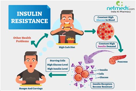 Insulin Resistance Symptoms Risk Factors Diagnosis And Prevention