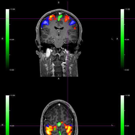 Brain Imaging Techniques Imagilys