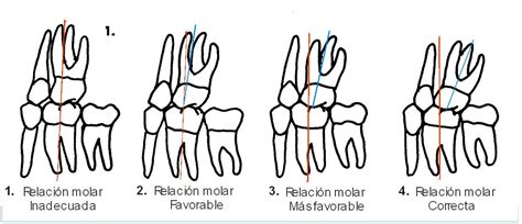 Las Seis Claves De La Oclusión Normal En Ortodoncia