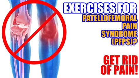 Exercises For Patellofemoral Pain Syndrome Youtube