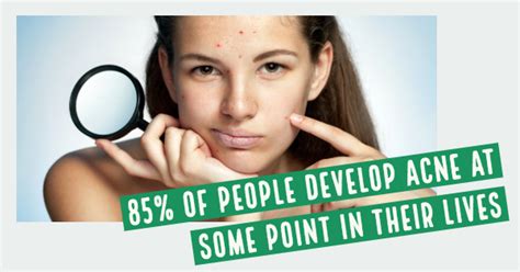 3 Common Teenage Skin Problems Dermatology Boca Raton Dermatologist