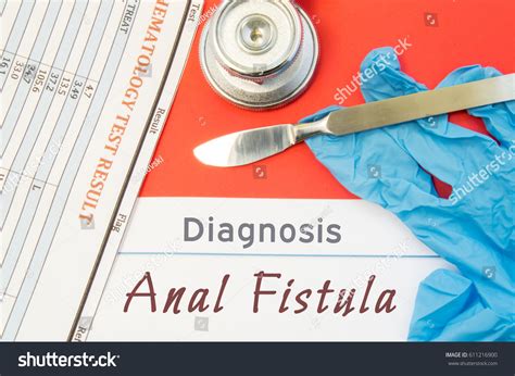 Surgical Diagnosis Anal Fistula Surgical Medical Stock Photo