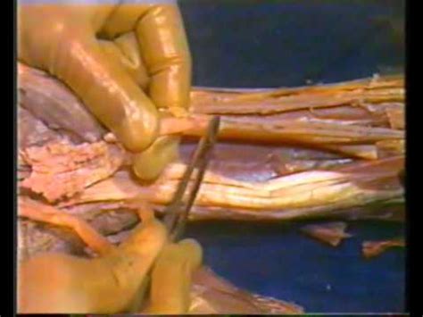 Zygote body is a free online 3d anatomy atlas. Human Anatomy - Upper Limb - YouTube