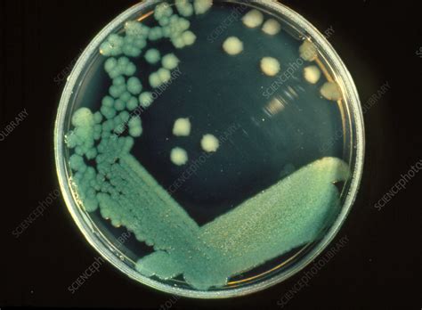 Pseudomonas Aeruginosa Bacteria Stock Image B2200060 Science
