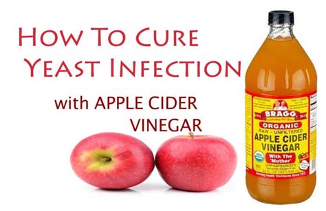 How To Use Apple Cider Vinegar For Yeast Infection Cure
