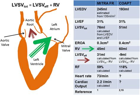 Assessment Of Mitral Stenosis By Echocardiography All Vrogue Co