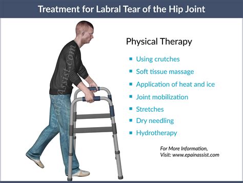 Hip Labral Tear Treatment