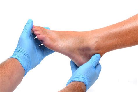 Can An Ankle Sprain Heal On Its Own North Central Texas Foot And Ankle
