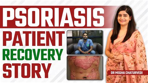 Psoriasis Patient Recovery Story By Dr Megha Chaturvedi Ayurvedic