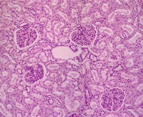 Kidney Cells Under Microscope Micropedia