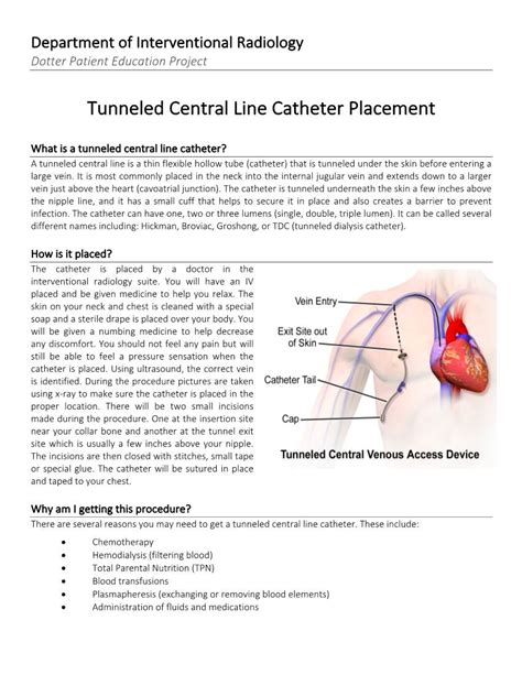 Tunneled Central Line Catheter Placement Docslib