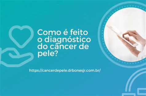 Blog sobre conteúdos de Câncer de Pele Dr Bonés Junior