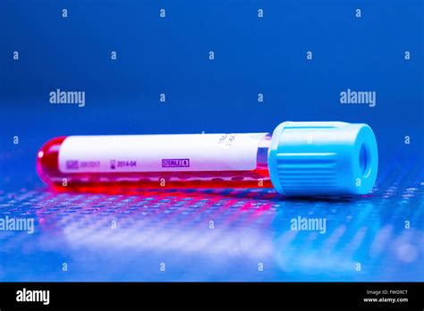 Vacutainer Blood Tube Hi Res Stock Photography And Images Alamy