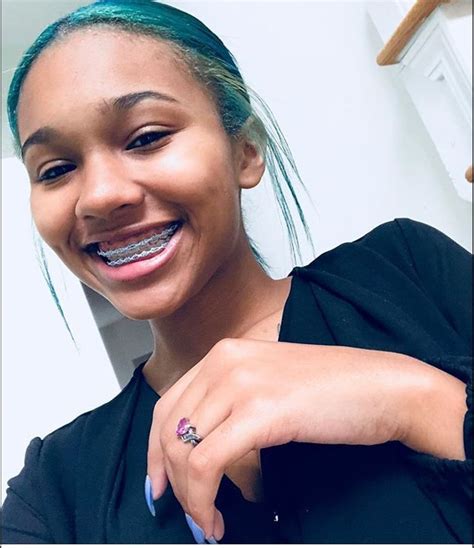 How do you put on rubber bands? Pin on Braces