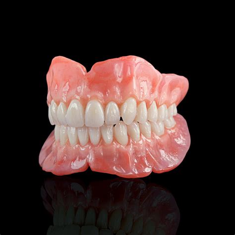 Complete Dentures — Ward Dental Lab