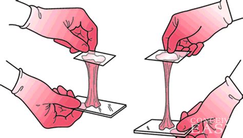 You cannot base anything like that. What Does Cervical Mucus Look Like When First Pregnant ...