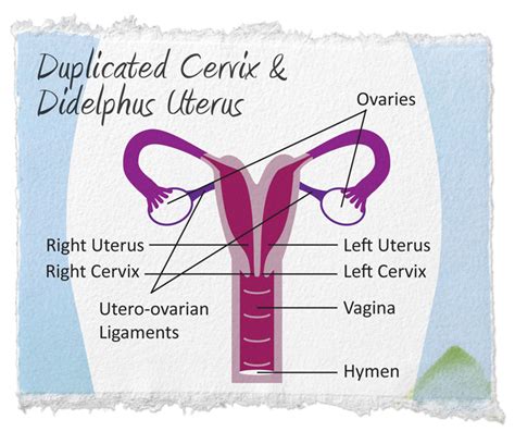 Cervical Duplication