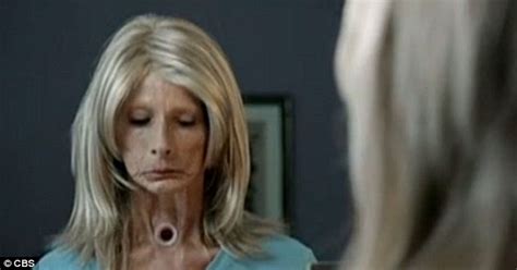 Graphic Anti Smoking Ads Featuring Cancer Victims Talking About Their