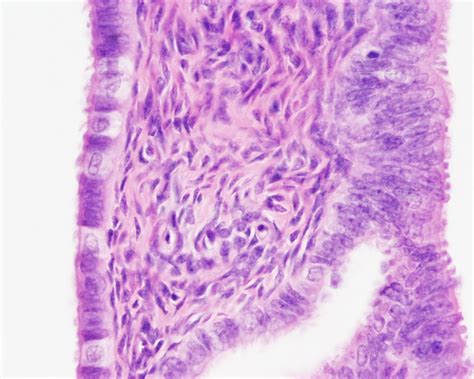 Fileuterine Tube Histology 04 Embryology
