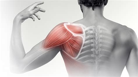 Shoulder Pain What Investigations Should I Order Sports Clinic Nq