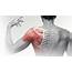 Shoulder Pain  What Investigations Should I Order Sports Clinic NQ