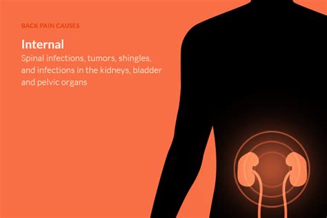 This article contains a list of organs of the human body. Reduce Back Pain While Sleeping: Causes & Positions