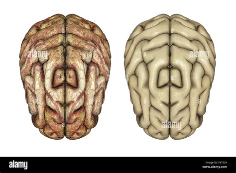3d Render Two Brains Hi Res Stock Photography And Images Alamy