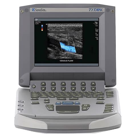 Sonosite Titan Portable Ultrasound For Sale