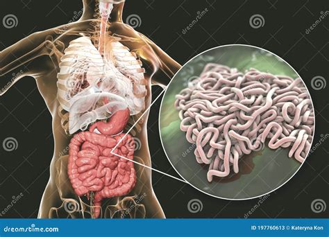 Vermi Parassiti Nell Intestino Umano Illustrazione Di Stock Illustrazione Di Anatomico