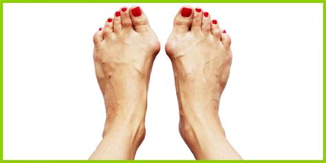 Daneben gibt es die versorgung mit vollprothesen und teilprothesen ( hemiprothesen ). Hallux Valgus Entstehung und Ursache - Hallux Valgus Schuhe